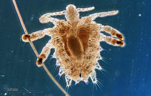 What Are Crabs Pubic Lice Know Your Status Today 