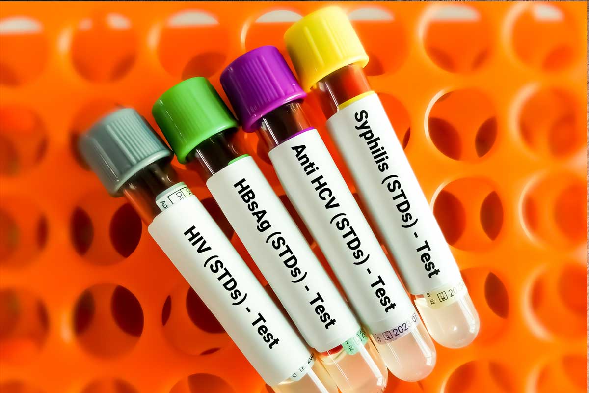 What Types of STD Tests Are There?