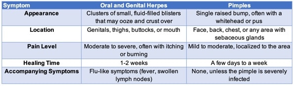 herpes vs pimple chart