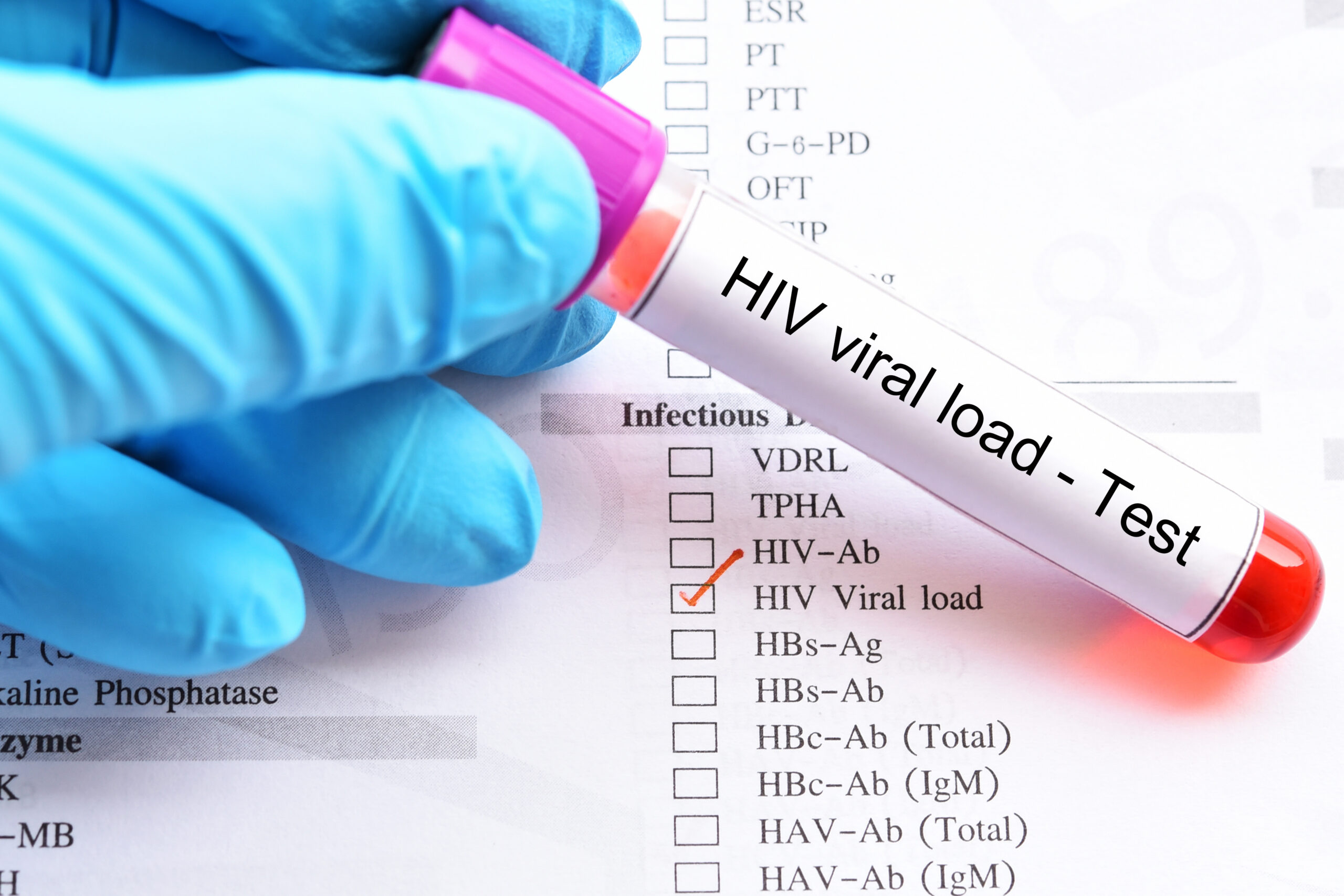 HIV RNA Test