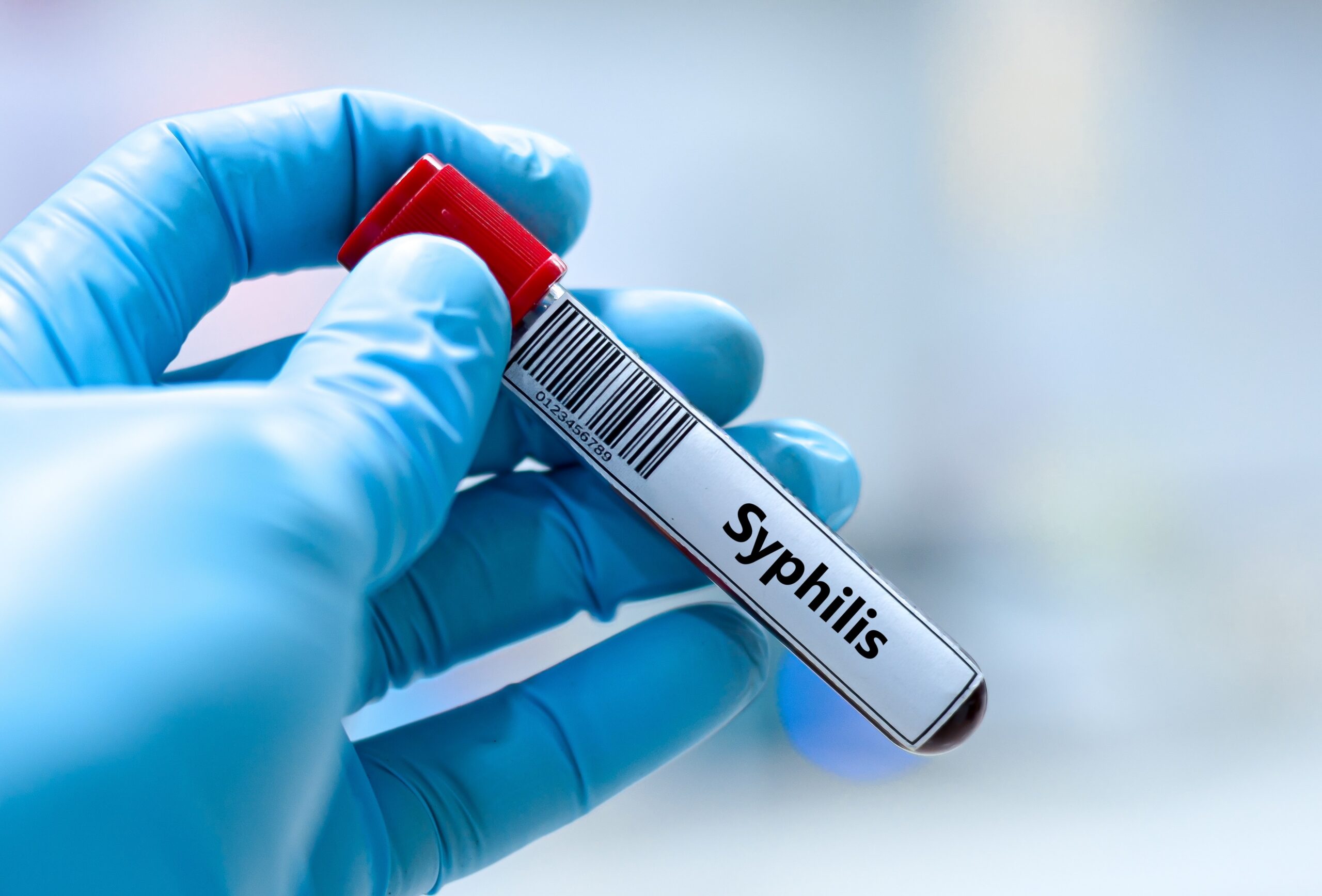 syphillis test window