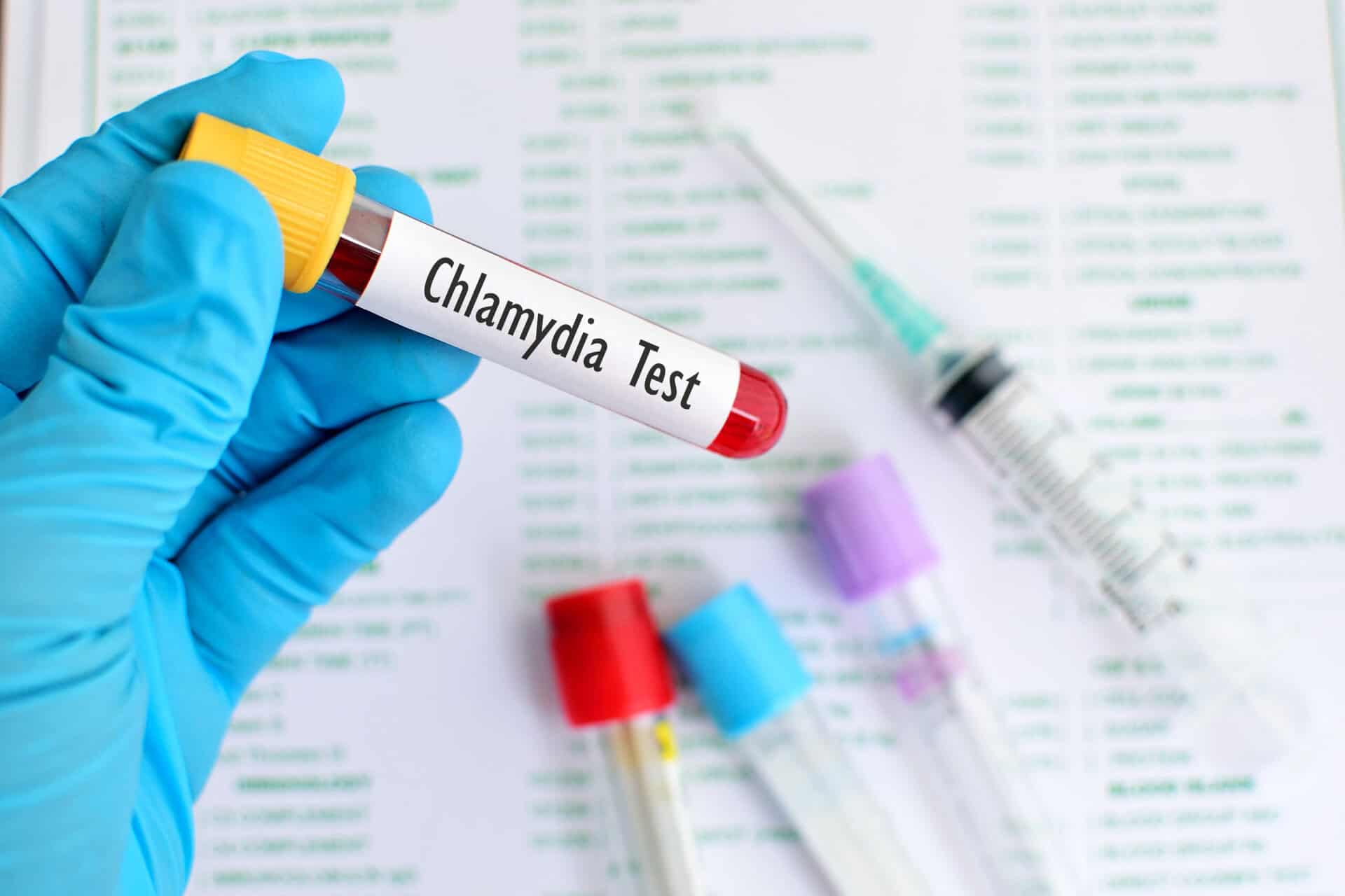 Chlamydia Test