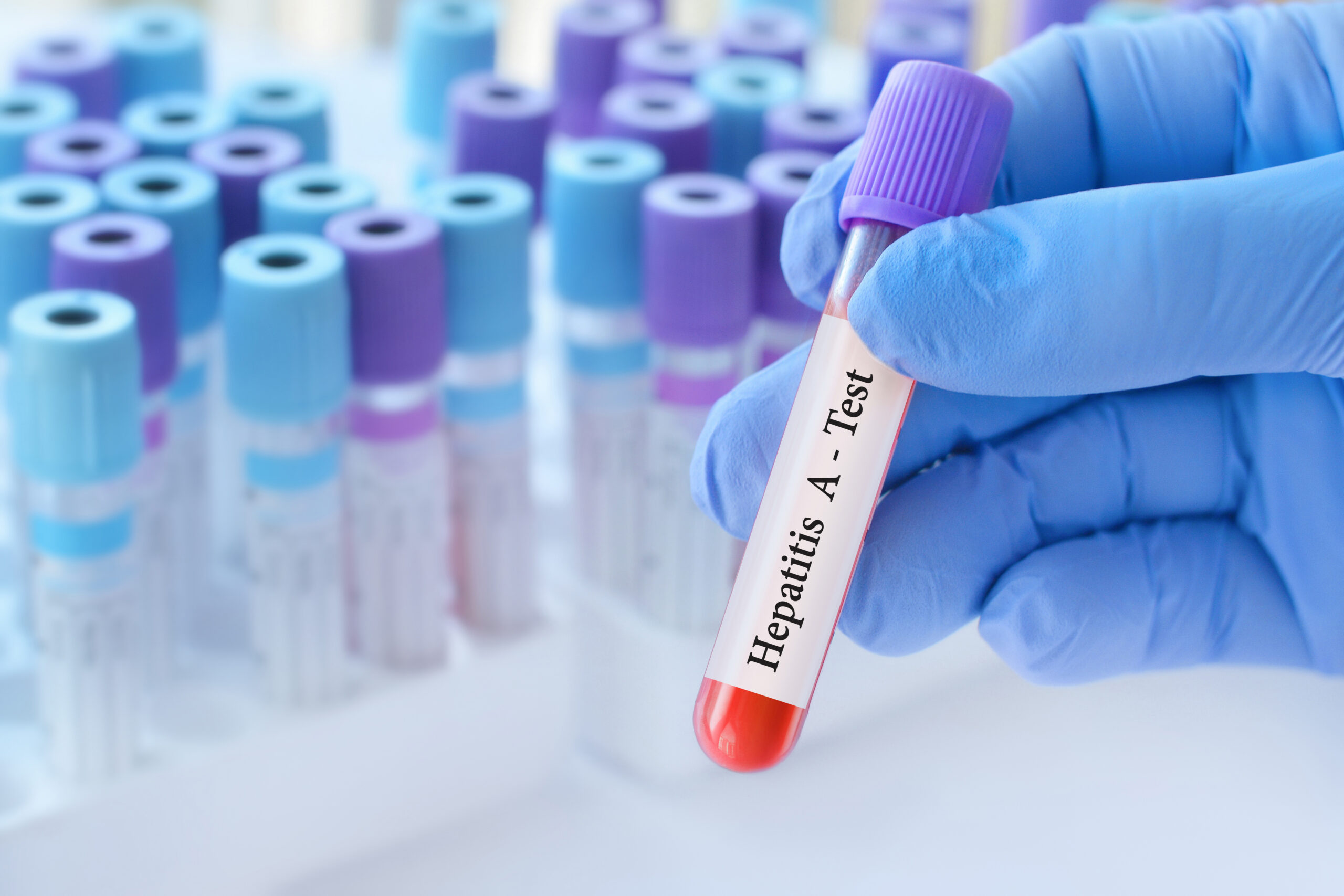 Hepatitis A Transmission